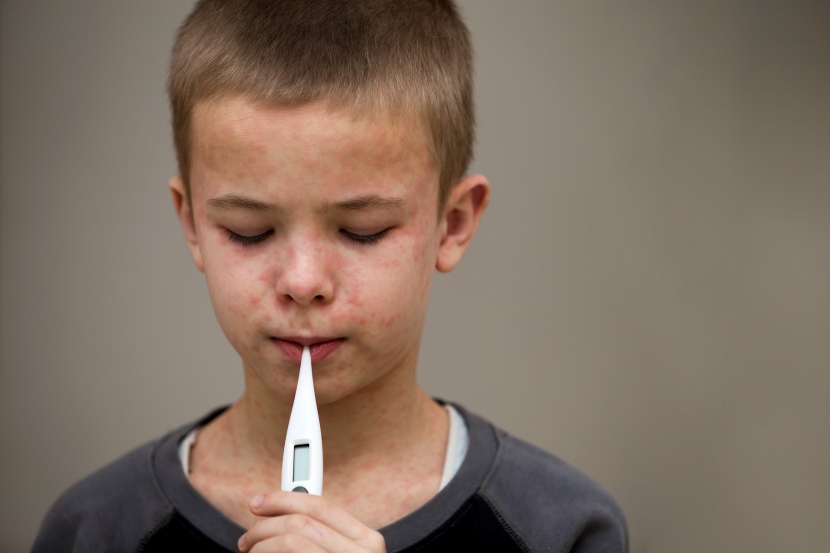 You are currently viewing Why Are Australian Airports Threatening From Measles Alerts? Find out Here – Travel And Tour World