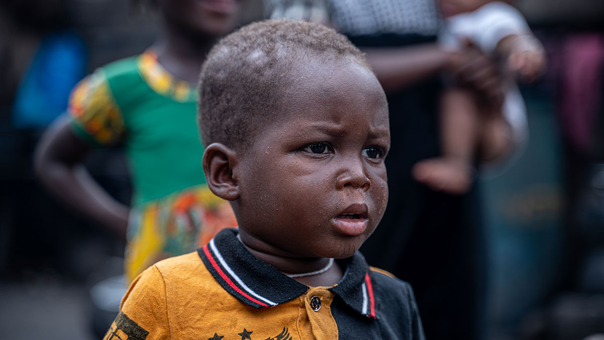 You are currently viewing Global Measles Outbreaks – Centers for Disease Control and Prevention | CDC (.gov)